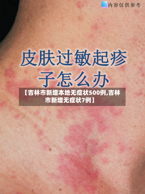 【吉林市新增本地无症状500例,吉林市新增无症状7例】-第2张图片