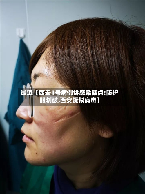 最近【西安1号病例讲感染疑点:防护服划破,西安疑似病毒】