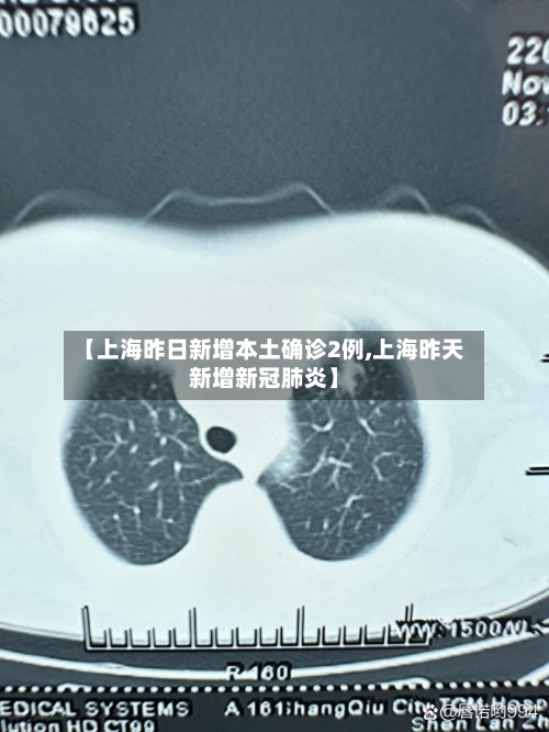 【上海昨日新增本土确诊2例,上海昨天新增新冠肺炎】