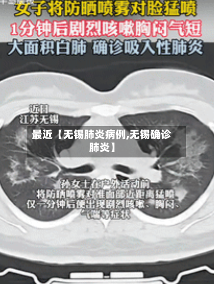 最近【无锡肺炎病例,无锡确诊肺炎】-第2张图片