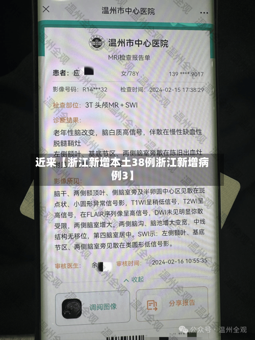 近来【浙江新增本土38例浙江新增病例3】