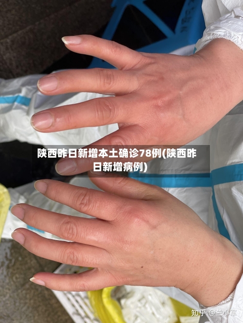 陕西昨日新增本土确诊78例(陕西昨日新增病例)-第2张图片