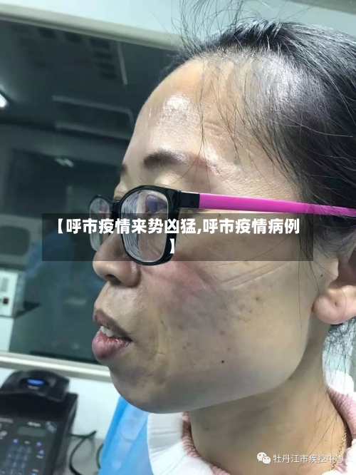 【呼市疫情来势凶猛,呼市疫情病例】