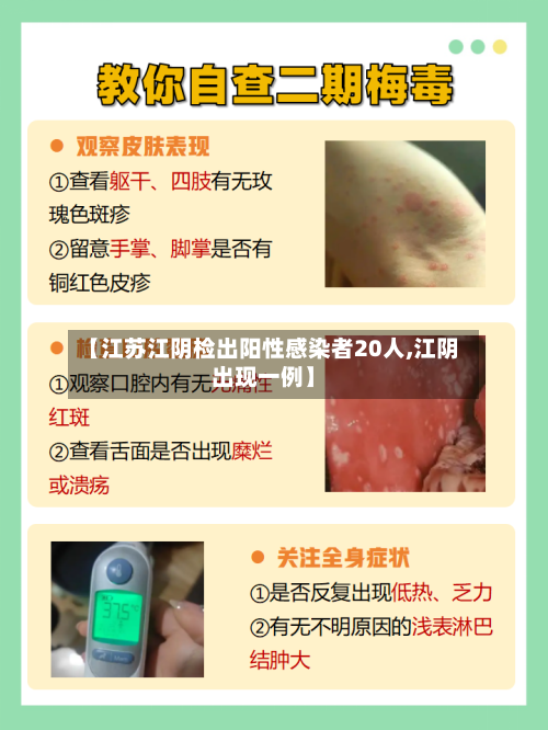 【江苏江阴检出阳性感染者20人,江阴出现一例】-第3张图片